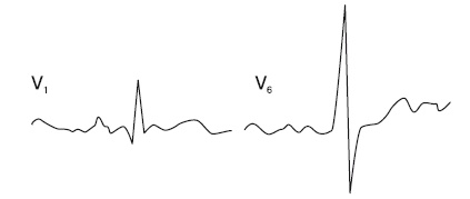 Иллюстрация к книге — Что показывает кардиограмма [i_034.jpg]