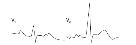 Иллюстрация к книге — Что показывает кардиограмма [i_035.jpg]