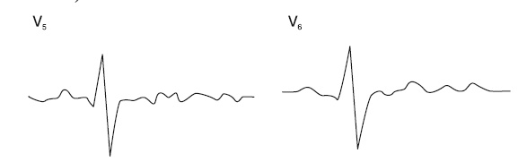 Иллюстрация к книге — Что показывает кардиограмма [i_036.jpg]