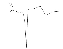 Иллюстрация к книге — Что показывает кардиограмма [i_038.jpg]