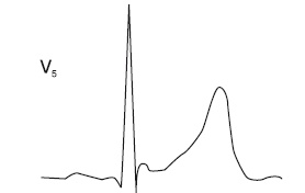 Иллюстрация к книге — Что показывает кардиограмма [i_039.jpg]