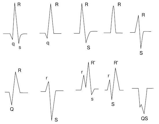 Иллюстрация к книге — Что показывает кардиограмма [i_052.jpg]