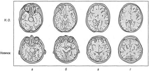 Иллюстрация к книге — Когнитивная психология [img_117.jpg]