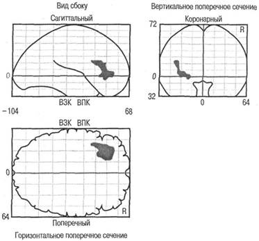 Иллюстрация к книге — Когнитивная психология [img_155.jpg]