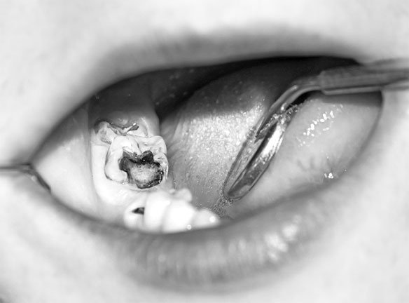 Иллюстрация к книге — Злые зубы [i_021.jpg]