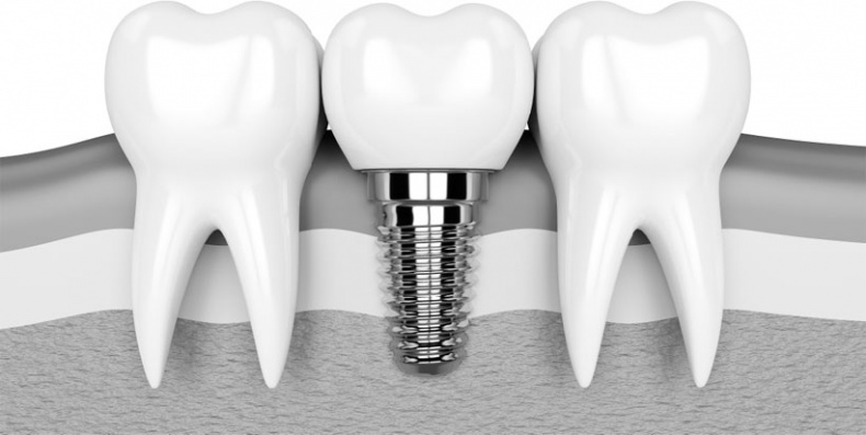 Иллюстрация к книге — Злые зубы [i_028.jpg]