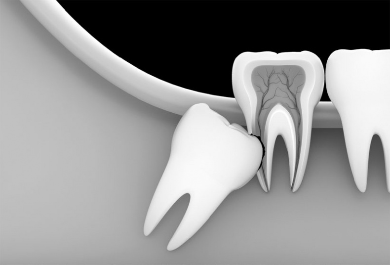 Иллюстрация к книге — Злые зубы [i_029.jpg]