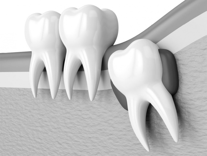Иллюстрация к книге — Злые зубы [i_030.jpg]