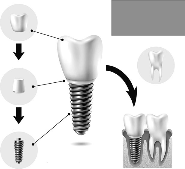 Иллюстрация к книге — Злые зубы [i_037.jpg]