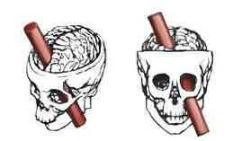 Иллюстрация к книге — История шарлатанства [i_099.jpg]