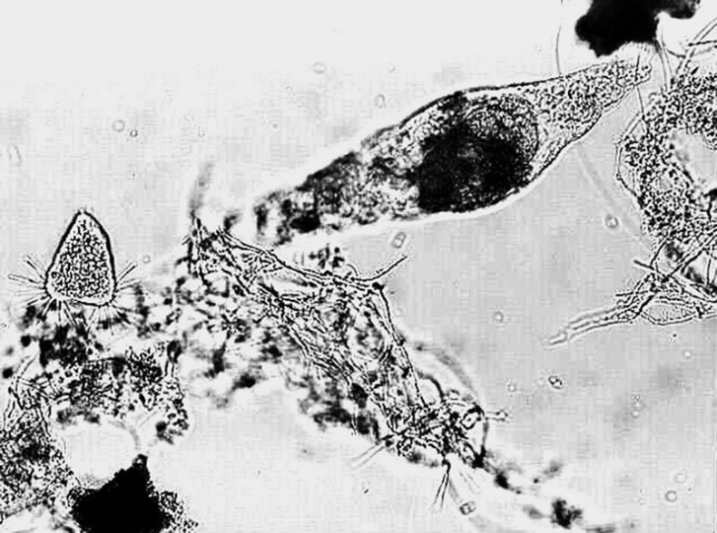 Иллюстрация к книге — Мифы о микробах и вирусах. Как живет наш внутренний мир [i_003.jpg]