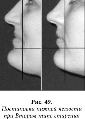 Иллюстрация к книге — Квантовая биомеханика тела. Методика оздоровления опорно-двигательного аппарата. Часть 2 [_38.jpg]