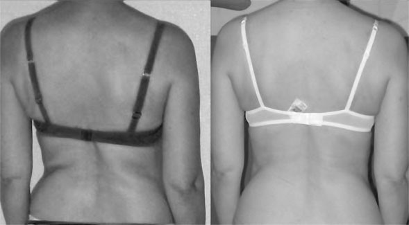 Иллюстрация к книге — Система Осьмионика. Самомоделирование осанки. Коррекция верхней половины тела [_125.jpg]