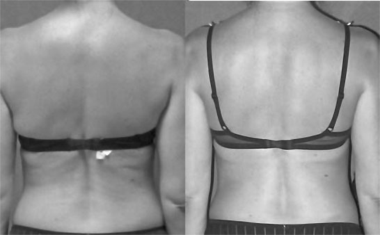 Иллюстрация к книге — Система Осьмионика. Самомоделирование осанки. Коррекция верхней половины тела [_126.jpg]