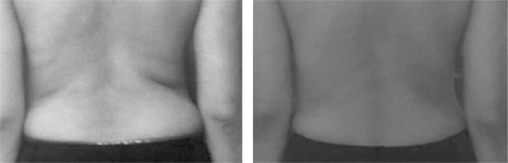 Иллюстрация к книге — Система Осьмионика. Самомоделирование осанки. Коррекция верхней половины тела [_127.jpg]