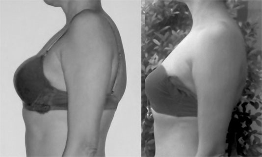 Иллюстрация к книге — Система Осьмионика. Самомоделирование осанки. Коррекция верхней половины тела [_130.jpg]