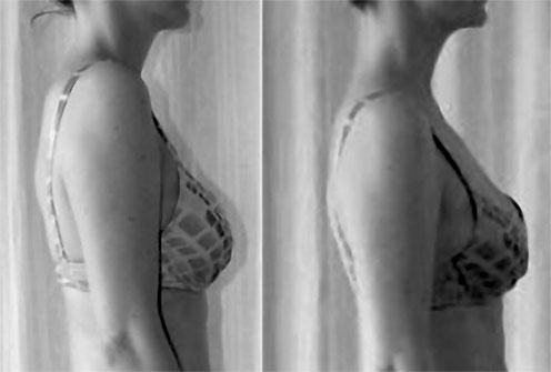 Иллюстрация к книге — Система Осьмионика. Самомоделирование осанки. Коррекция верхней половины тела [_131.jpg]