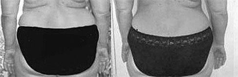 Иллюстрация к книге — Система Осьмионика. Самомоделирование осанки. Коррекция верхней половины тела [_132.jpg]