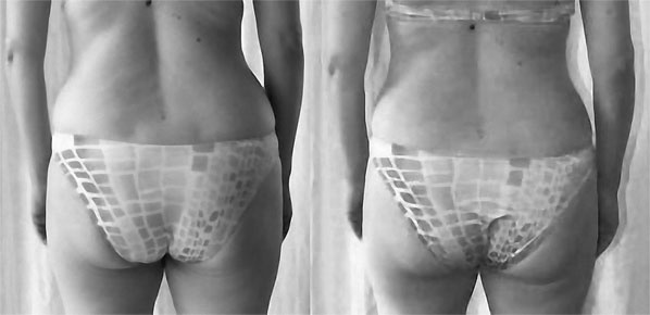 Иллюстрация к книге — Система Осьмионика. Самомоделирование осанки. Коррекция верхней половины тела [_134.jpg]