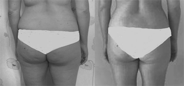 Иллюстрация к книге — Система Осьмионика. Самомоделирование осанки. Коррекция верхней половины тела [_135.jpg]