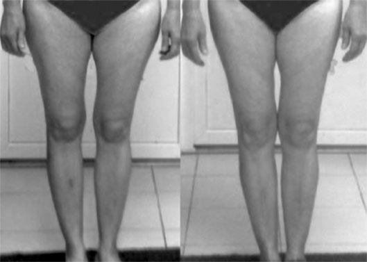 Иллюстрация к книге — Система Осьмионика. Самомоделирование осанки. Коррекция верхней половины тела [_137.jpg]