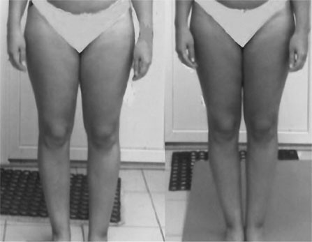 Иллюстрация к книге — Система Осьмионика. Самомоделирование осанки. Коррекция верхней половины тела [_138.jpg]