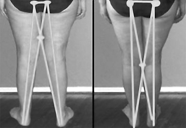 Иллюстрация к книге — Система Осьмионика. Самомоделирование осанки. Коррекция верхней половины тела [_14.jpg]