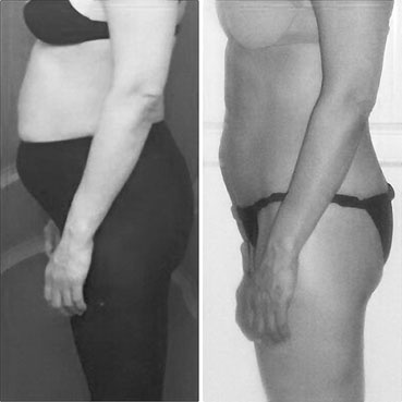 Иллюстрация к книге — Система Осьмионика. Самомоделирование осанки. Коррекция верхней половины тела [_142.jpg]