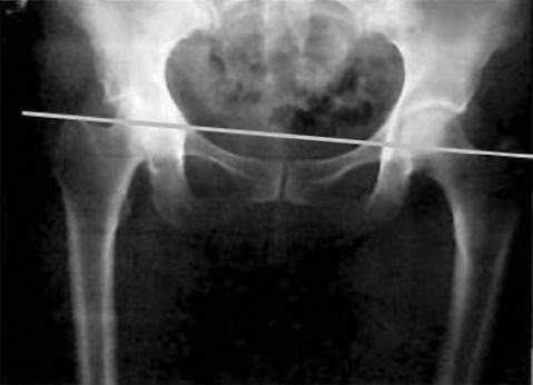 Иллюстрация к книге — Система Осьмионика. Самомоделирование осанки. Коррекция верхней половины тела [_16.jpg]