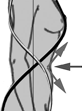 Иллюстрация к книге — Система Осьмионика. Самомоделирование осанки. Коррекция верхней половины тела [_21.jpg]