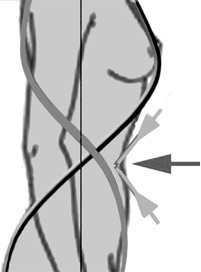 Иллюстрация к книге — Система Осьмионика. Самомоделирование осанки. Коррекция верхней половины тела [_23.jpg]