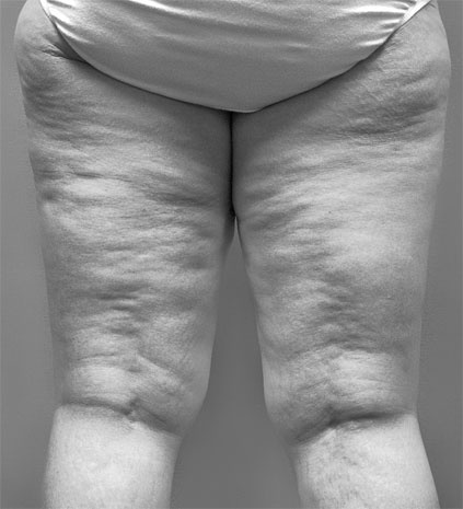 Иллюстрация к книге — Система Осьмионика. Самомоделирование осанки. Коррекция верхней половины тела [_62.jpg]