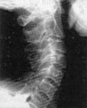 Иллюстрация к книге — Система Осьмионика. Самомоделирование осанки. Коррекция верхней половины тела [_70.jpg]