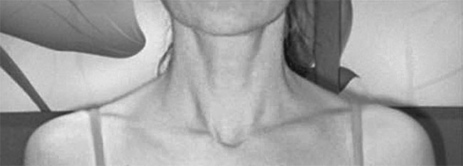 Иллюстрация к книге — Система Осьмионика. Самомоделирование осанки. Коррекция верхней половины тела [_94.jpg]