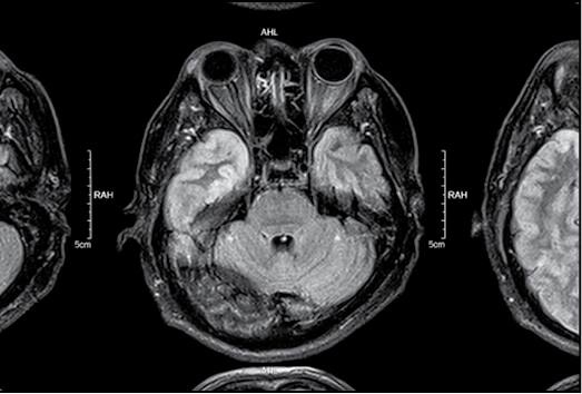 Иллюстрация к книге — Безумие ли? Как психиатры выставляют диагноз? [i_036.jpg]