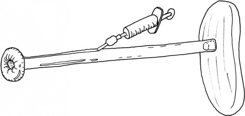 Иллюстрация к книге — Wow, anus! Неожиданные откровения о том самом месте [i_018.jpg]