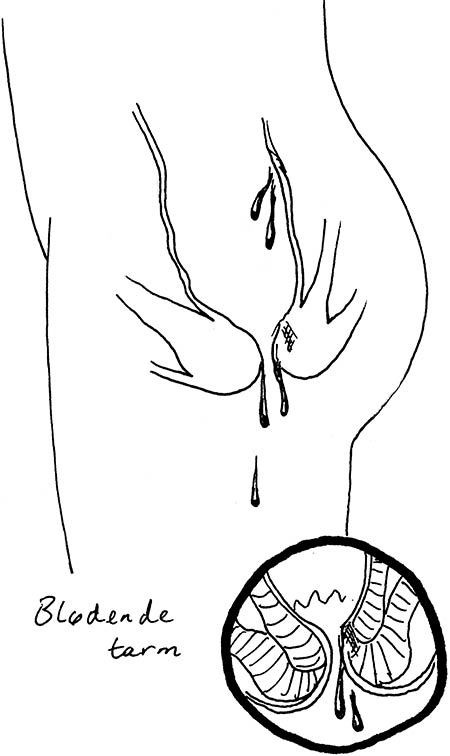 Иллюстрация к книге — Wow, anus! Неожиданные откровения о том самом месте [i_041.jpg]