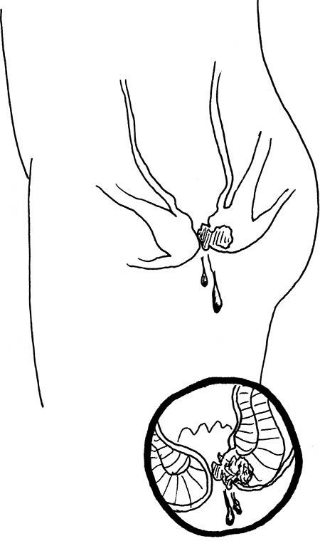 Иллюстрация к книге — Wow, anus! Неожиданные откровения о том самом месте [i_051.jpg]