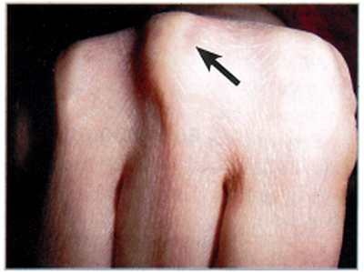 Иллюстрация к книге — Секреты китайских целителей: диагностика и лечение болезней по руке [_09.jpg]