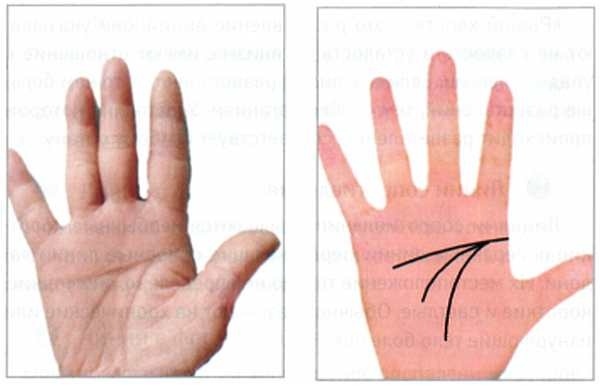 Иллюстрация к книге — Секреты китайских целителей: диагностика и лечение болезней по руке [_17.jpg]