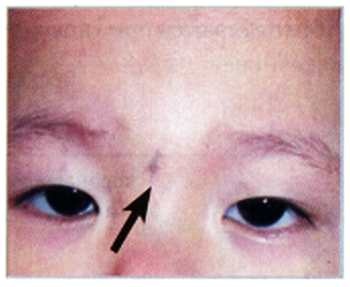 Иллюстрация к книге — Секреты китайских целителей: диагностика и лечение болезней по руке [_20.jpg]