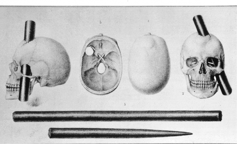 Иллюстрация к книге — Мозговодство  [i_018.jpg]
