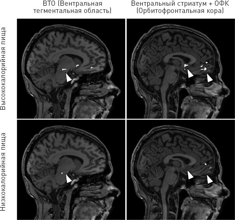 Иллюстрация к книге — Голодный мозг. Как перехитрить инстинкты, которые заставляют нас переедать [i_046.jpg]