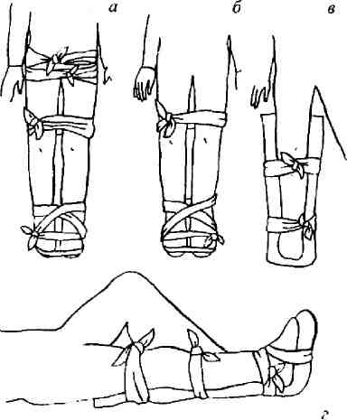 Иллюстрация к книге — Учебник для сестер милосердия  [i_045.jpg]