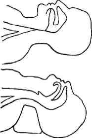 Иллюстрация к книге — Учебник для сестер милосердия  [i_051.jpg]