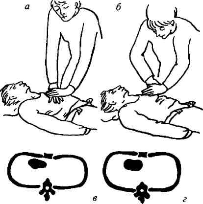 Иллюстрация к книге — Учебник для сестер милосердия  [i_054.jpg]
