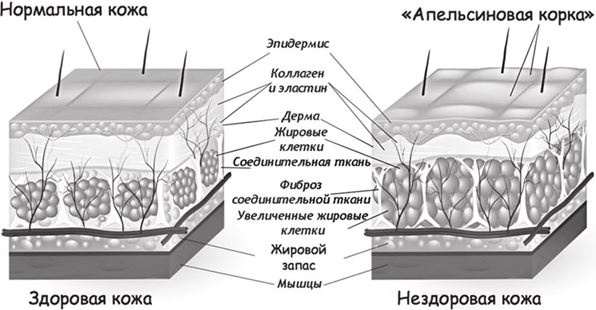 Иллюстрация к книге — Кожа: мифы и правда о самом большом органе [i_011.jpg]