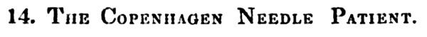 Иллюстрация к книге — Безумная медицина. Странные заболевания и не менее странные методы лечения в истории медицины [i_023.jpg]