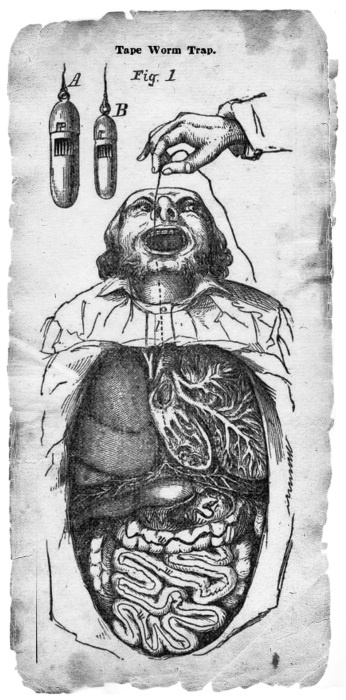 Иллюстрация к книге — Безумная медицина. Странные заболевания и не менее странные методы лечения в истории медицины [i_039.jpg]