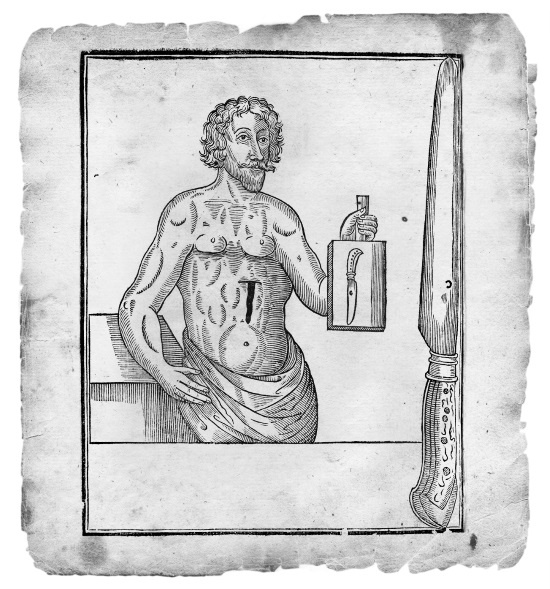 Иллюстрация к книге — Безумная медицина. Странные заболевания и не менее странные методы лечения в истории медицины [i_045.jpg]